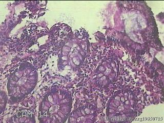 直乙结肠粘膜图30