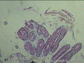 直乙结肠粘膜图9