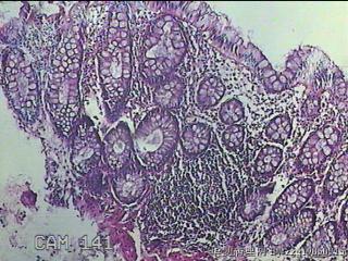 直乙结肠粘膜图4