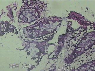 直乙结肠粘膜图16