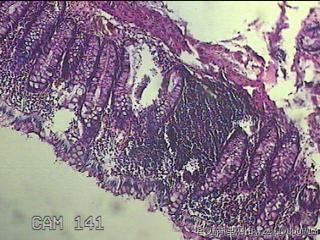 直乙结肠粘膜图27