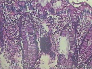 直乙结肠粘膜图39
