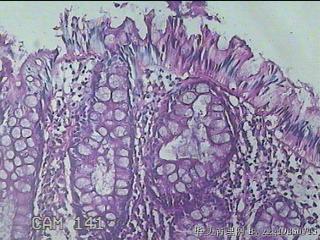 直乙结肠粘膜图22