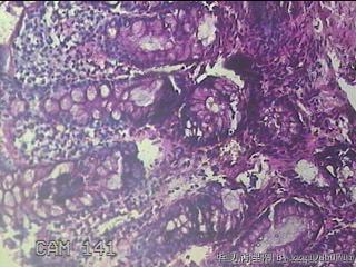 直乙结肠粘膜图36