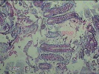 直乙结肠粘膜图10
