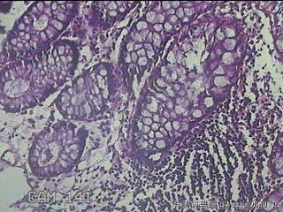 直乙结肠粘膜图18