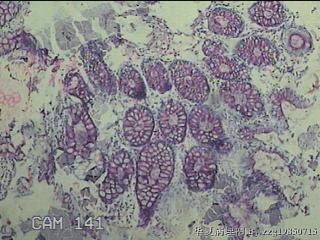 直乙结肠粘膜图8