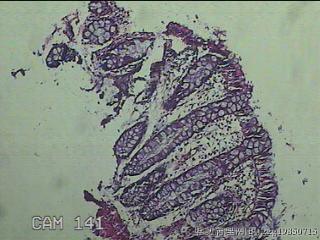 直乙结肠粘膜图5