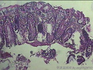 直乙结肠粘膜图24