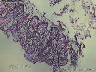 直乙结肠粘膜图2