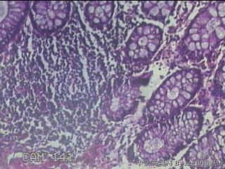 直乙结肠粘膜图19