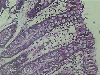 直乙结肠粘膜图15