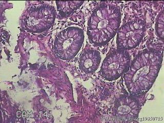 直乙结肠粘膜图31
