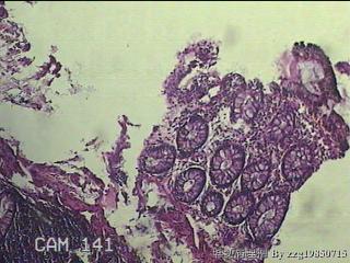 直乙结肠粘膜图29