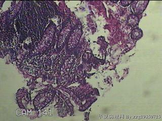 直乙结肠粘膜图28