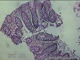 直乙结肠粘膜图1