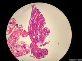 直肠活检组织图2