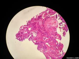 直肠活检组织图7