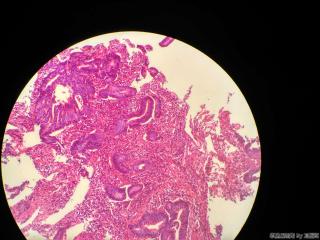 直肠活检组织图13