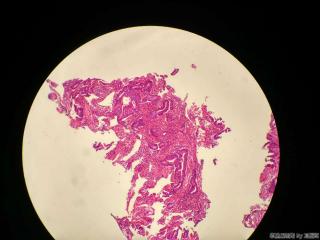 直肠活检组织图11