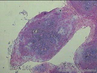 食管粘膜图2