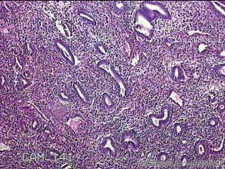 宫腔内膜组织图19