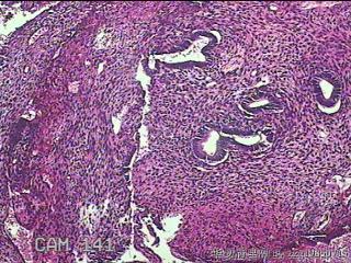 子宫内膜组织图39