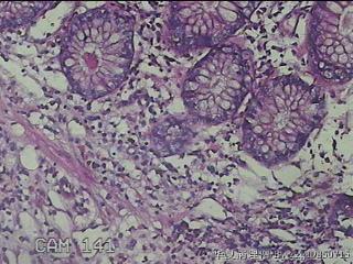 升结肠粘膜图22