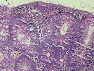升结肠粘膜图16
