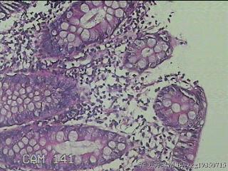升结肠粘膜图28