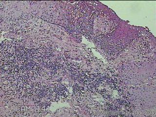 食管食管中段粘膜图5