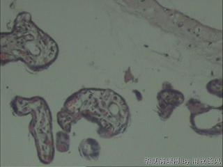 部分胎盘组织图9