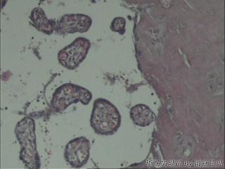 部分胎盘组织图8