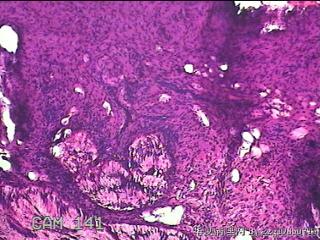 宫颈组织图50