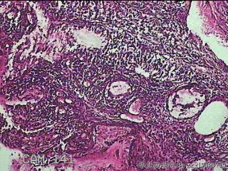 宫颈组织图2