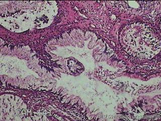 宫颈组织图40