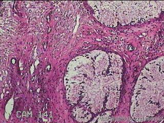 宫颈组织图13