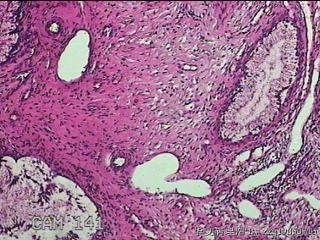 宫颈组织图39