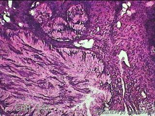宫颈组织图49