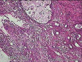 宫颈组织图31