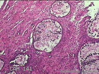 宫颈组织图93