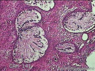 宫颈组织图92