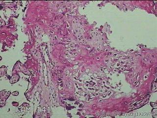 胎盘组织图38