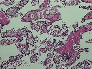 胎盘组织图30
