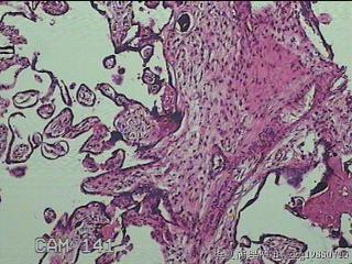 胎盘组织图35