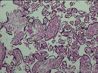 胎盘组织图17