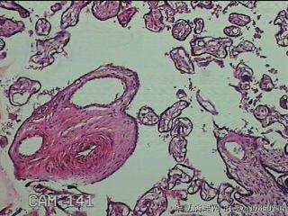 胎盘组织图33