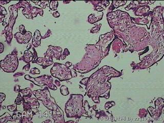 胎盘组织图12