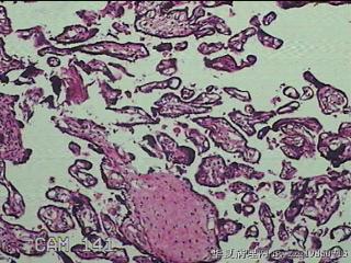 胎盘组织图40