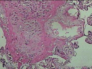 胎盘组织图6